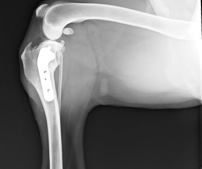 整形外科イメージ写真